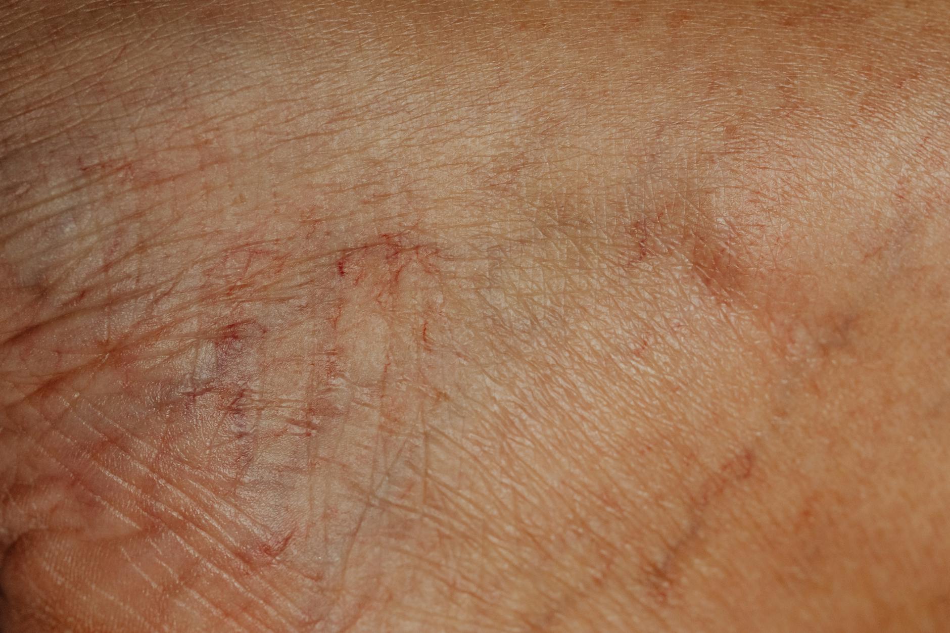 Cuticle Care For Dry Skin